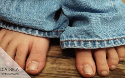 Wrastające paznokcie u stóp – przyczyny, jak zapobiegać, jak leczyć?
