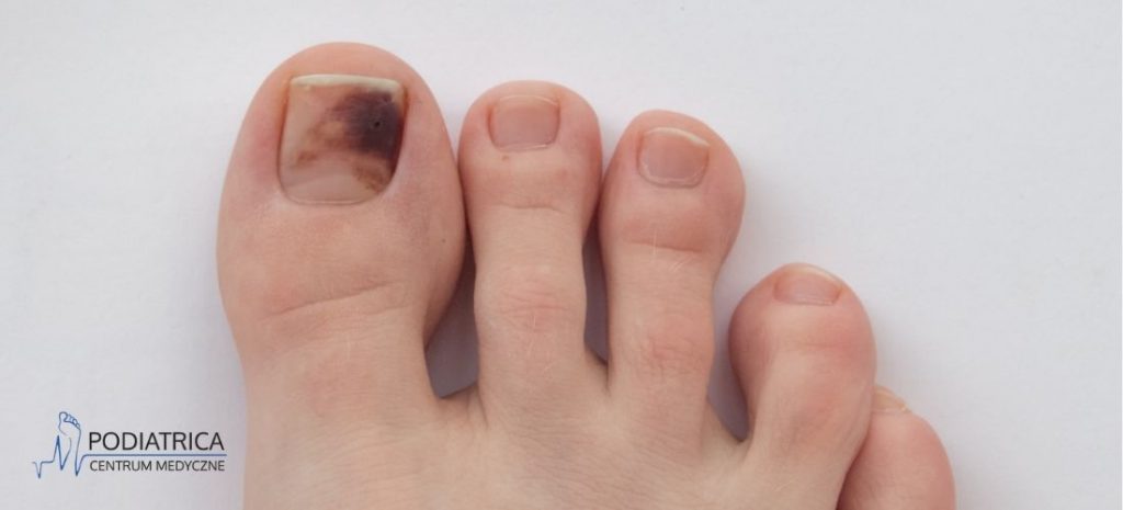 6. "Winter Nail Color Inspiration for Your 2024 Toenail Look" - wide 6